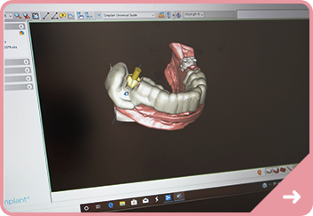 02.精確な診断、充実の設備 シミュレーションソフトの導入のイメージ写真